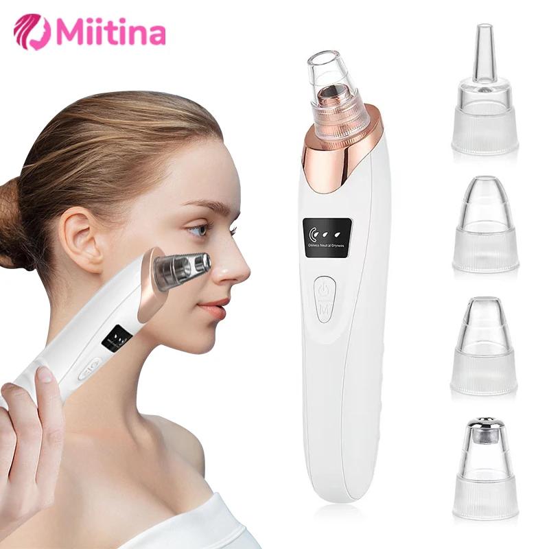 Removedor de cravo elétrico usb rosto limpeza profunda poros máquina beleza removedor de pele morta rosto vácuo remoção cravo cuidados com a pele